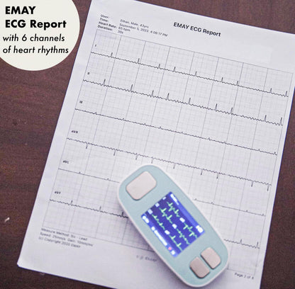 EMAY 6L Portable ECG Monitor | Record ECG and Heart Rate in 6 Channels | Compatible with Smartphone and PC | No Subscription Required